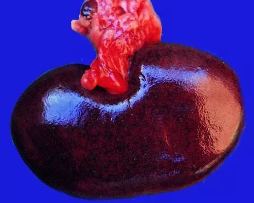 公司新闻猪丹毒专栏之猪丹毒死灰复燃你了解多少